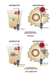 The Anemia Of Chronic Disease An Outmoded Diagnosis