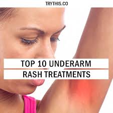 No More Itchy Armpits Top 10 Underarm Rash Treatments Armpitsodor Rash Treatment Underarm Rash Armpit Rash