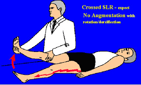 Image result for Crossed-Leg Test