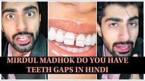 Close the gap for any missing teeth. Mridul Madhok Do You Have Teeth Gaps In Hindi Youtube