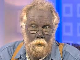 Leave in for colloidalcare.com and or michael clark's health, hair and skin products, specifically disclaims responsibility or liability for any loss or hardship that. Real Life Blue Man Dies After Heart Attack Stroke