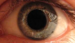 When the eye's surface is too dry, it can become irregular, and light entering the eye can scatter. How Monitors Destroyed Our Eyes Iristech