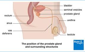 Men who have/had a close relative with. Prostate Cancer Health Information Bupa Uk