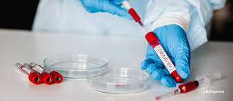 A coronavirus is a common virus that causes an infection in your nose, sinuses, or upper throat. La Estrategia De Alemania Frente Al Covid 19 Acciones Multisectoriales