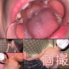 口内 観察
