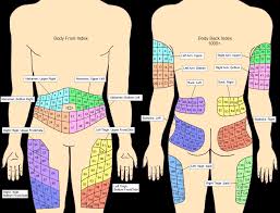 Injection Sites Index Diabetes M