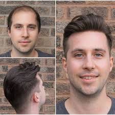Make your front hairline perfect natural looking! French Lace Center With Poly Around Stock Hair Replacement System For Men Hair Replacement Systems Hair System Hair Replacement