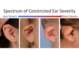 نتیجه جستجوی لغت [constricted] در گوگل