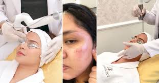 All-nurse film 'Siglo ng Kalinga' holds successful premiere