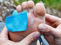 Then we cover them in socks and shoes and keep them out of sight. Should You Pop A Blister When To Do It Safe Methods And Tips