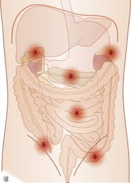 Dolor abdominal - ScienceDirect
