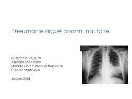 Les infos, chiffres, immobilier, hotels & le mag. Pneumonie Aigue Communautaire Ppt Telecharger