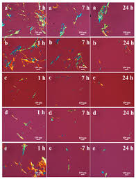 All new jobs in one place, ordered by relevance. Fibers Free Full Text Cellulose Dissolution In Ionic Liquid Under Mild Conditions Effect Of Hydrolysis And Temperature Html