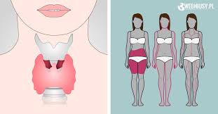 Niedoczynność tarczycy, niedoczynność tarczycy twoja tarczycy znajduje się w twojej szyi. 12 Subtelnych Objawow Swiadczacych O Problemach Z Tarczyca Ktorych Nigdy Nie Nalezy Ignorowac