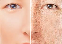 Maybe you would like to learn more about one of these? 18 Produk Skincare Terbaik Untuk Kulit Kering Update 2021