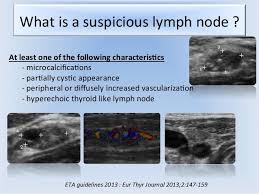 Pin By Ah Ben On Ultrasound Diagnostic Medical Sonography Student Ultrasound Physics Sonography Student