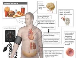 Check spelling or type a new query. 10 Faktor Yang Menyebabkan Tekanan Darah Tinggi One Stop Solution System Detoxyourbody Take Care Of Your Body It S The Only Place You Have To Live Merawat