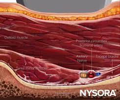 Image result for Axillary Nerve Block