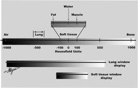In digital imaging, which occur when the size of the image matrix increases? Computed Tomography Radiology Key