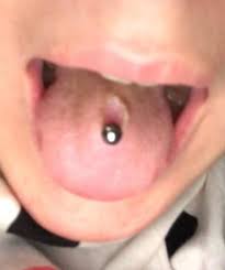 Zungenpiercing Entzundet Und Trotzdem Verheilt Gesundheit Und Medizin Piercer