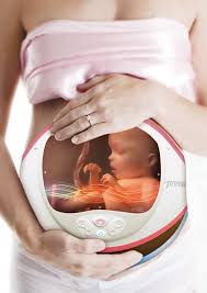 Pin On Femtech And Women S Health Technology