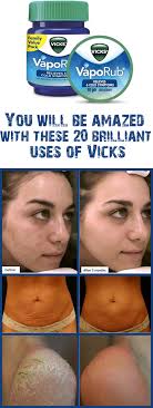 9 Surprising Uses For Vicks Vaporub Health And Beauty Vicks Vaporub Uses For Vicks