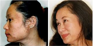 Nicole — VILLANI MEDICAL