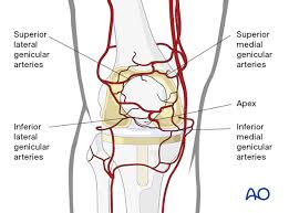 Image result for Traumatic Arthrotomy