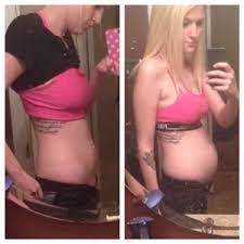 Stomach ulcers often respond well to treatment and sometimes heal within weeks. Bloat Vs Belly Let 39 S See Pics September 2015 Babies Forums What To Expect