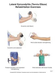 Summit Medical Group Tennis Elbow Exercises Tennis Elbow Tennis Elbow Exercises Elbow Exercises