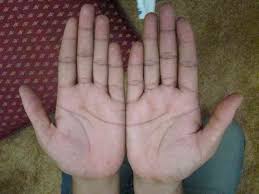 Inherited money line in palmistry or property line: Know What Does The Half Moon On Your Palm Mean