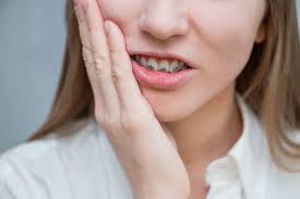 Another quick fix would be to go out and buy a cream or paste to help heal the sores. Painful Braces Relieve Braces Pain Jefferson Dental Orthodontics