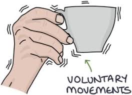 Image result for Essential Tremor