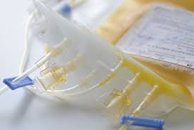 Image result for Platelet Transfusion