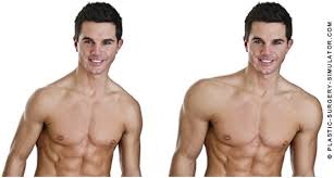 Virtual Plastic Surgery Simulator