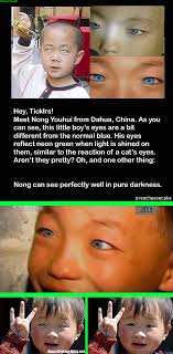 Does China S Cat Eyed Boy Really Have Night Vision His Eyes Fun Facts Eyes