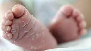 Newborn Dies After Rat Bites In Indian Hospital Mother