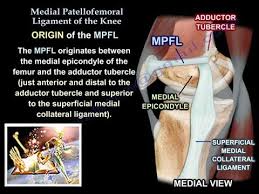 Olecrenon process, proximal radial notch, lateral styloid process, towards 'pinky'. Medial Patellofemoral Ligament Of The Knee Anatomy Everything You Need To Know Dr Nabil Ebraheim Youtube