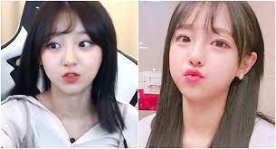 그 속에 과거, 관계를 맺었던 콜튼과 조우한다. Bj ì™¸ì§ˆí˜œê°€ ë°ížŒ ì„±í˜•í•  ë•Œ ì œì¼ ë¬´ì„œì› ë˜ ê²ƒ ë™ì˜ìƒ