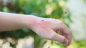 Image result for mosquito bite