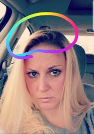 I dont share this. My whole life I've had very long, very thick, and what I  thought was healthy hair. I have kept my diagnosis to myself for about 3  years now.