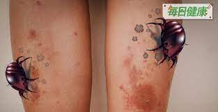 塵蟎 如何消滅才好 3招 殺蟎 殺很大 每日健康healt watercolor tattoo tattoos