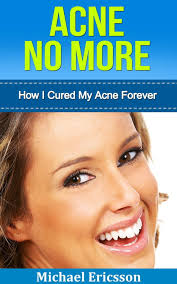 Acne No More: How I Cured My Acne Forever eBook by Dr. Michael Ericsson