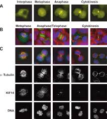 Olympus microcopes for a multitude of imaging techniques. Changes In Kif14 Localization Coincide With Distinct Cell Cycle Stages Download Scientific Diagram