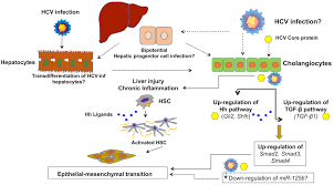 Hepatitis c (hcv) is a contagious viral infection that causes liver inflammation. Hepatitis C Virus Infection And Cholangiocarcinoma The American Journal Of Pathology