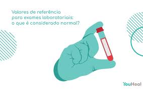 Ou veja os convênios aceitos. Valores De Referencia Para Exames Laboratoriais O Que E Considerado Normal Clinica You Heal