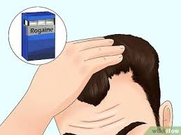 What would cause a receding hairline in a teenager? 10 Ways To Fix A Receding Hairline Wikihow
