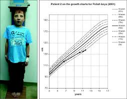Cholestatic Syndromes In Childhood And Catch Up Growth