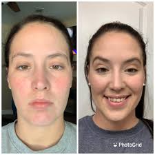 Before and after hair color transformation