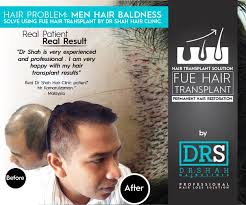 Hair loss treatment malaysia is one of the most googled aesthetic clinic related terms locally. Hair Growth Clinic